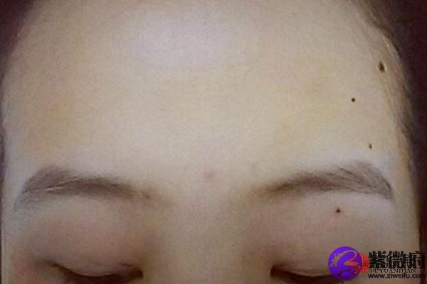 三颗痣成三角形的女人命运好不好