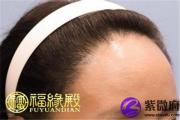 面相学额头代表了什么面相学额头知识