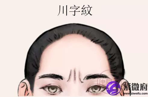 川字纹川字纹是指印堂有三条竖直的纹路,形似川字.