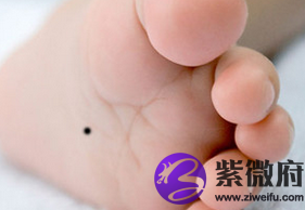 脚下有痣在痣相图解中有何寓意？(脚下有痣有什么说法)
