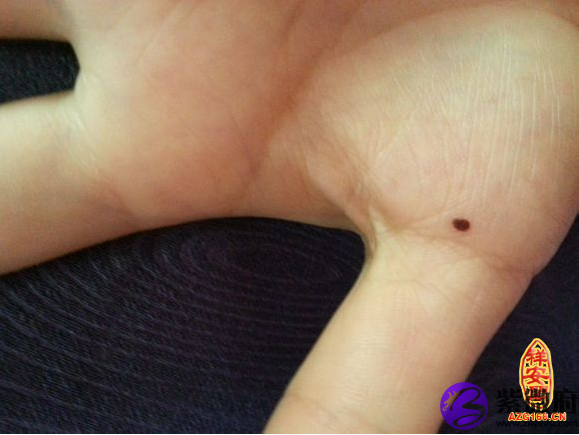 掌心痣的传说故事