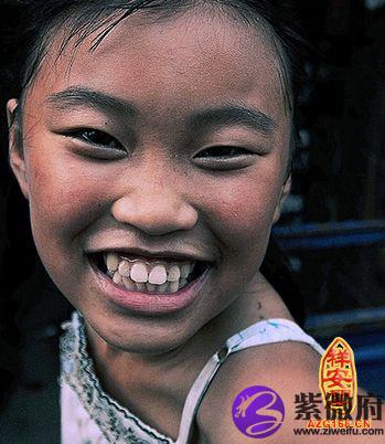 们拥有一双像张曼玉般的兔仔牙(兔齿),他们大都像个大小孩般天真活泼