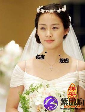 下巴痣相图解大全