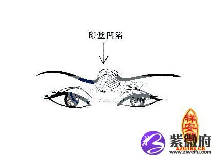 解读印堂凹陷面相
