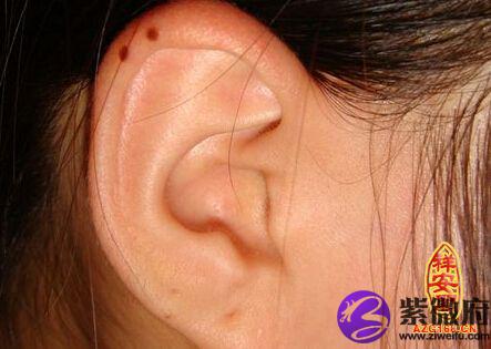 耳朵上有痣的痣相图解