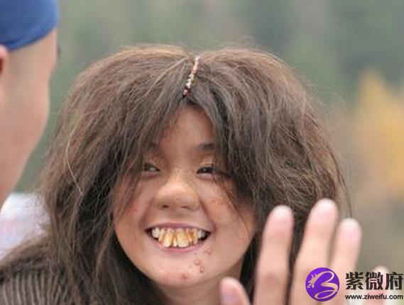 猪胆鼻面相分析