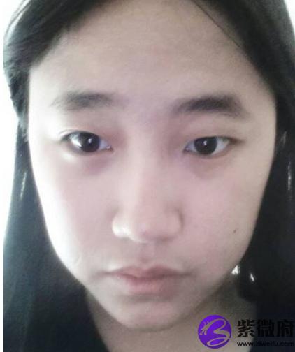 眼睛大小不一样面相
