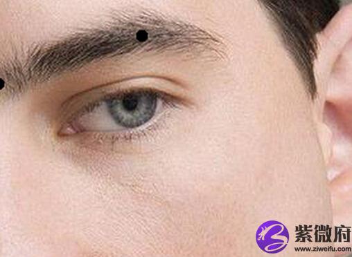 最全的男人面相痣吉凶揭秘