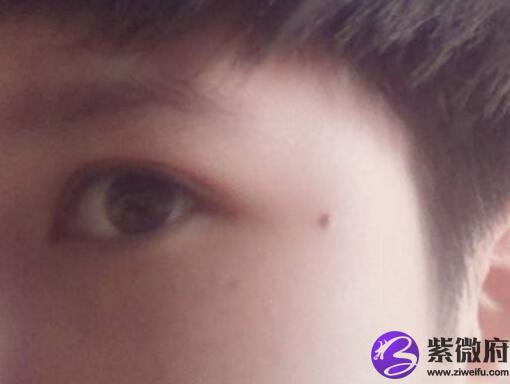 面相痣图解夫妻宫有痣好吗