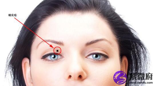 女人右眼皮有痣的这种面相好吗下眼皮有痣代表什么