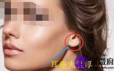 耳垂大是不是代表有好命