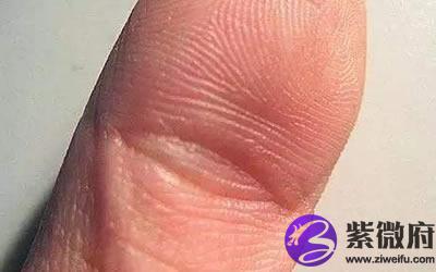 夫子眼是真的旺夫吗 夫子眼有什么寓意(夫子眼的人多不多)