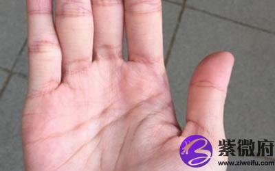 夫子眼和凤眼的区别夫子眼就是凤眼纹吗