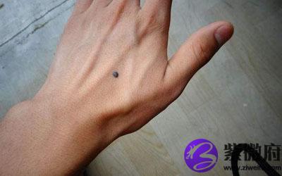 手背有痣的人婚姻运势如何