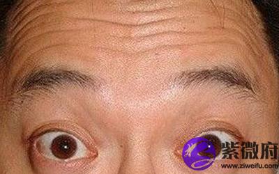 据说额头有三才纹十有九贵