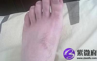 脚背长毛的女人会好命吗