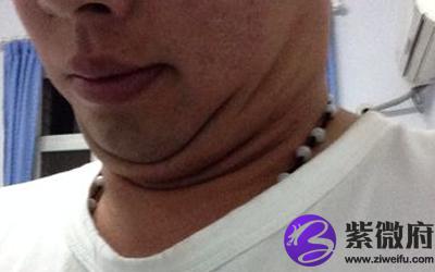 男人的脖子又短又粗是晚年有钱的象征吗