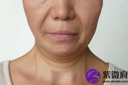 嘴角往下垂的男人运势怎样