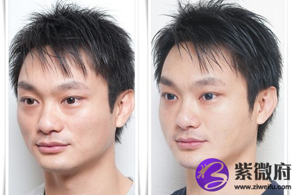 男人泪沟很深是不是事业不太顺利