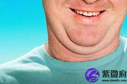 双下巴的人面相有什么说法