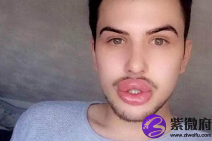 嘴唇厚的男人能不能获得成功呢