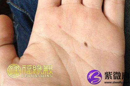 手心有痣好不好手心有痣意味着什么