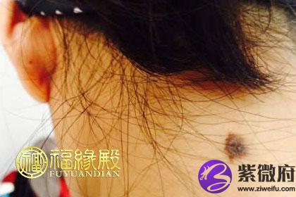 后颈有痣的女人有什么说法
