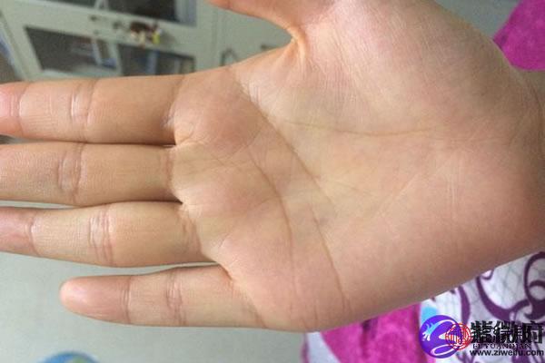 没有智慧线代表什么