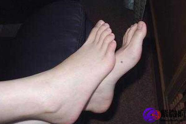 女人左脚上长痣图解 左脚长痣含义