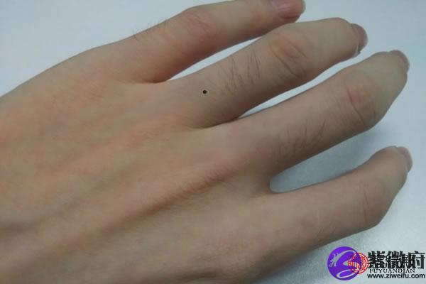 男人无名指上有颗痣