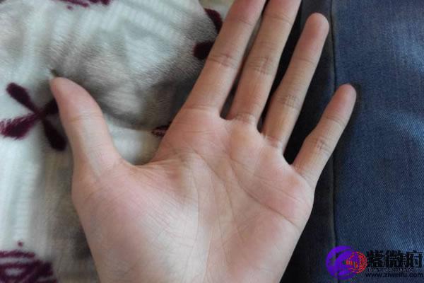 掌心有痣感情有变:长在掌心上的痣其实也是一颗苦情痣,也就是说拥有这