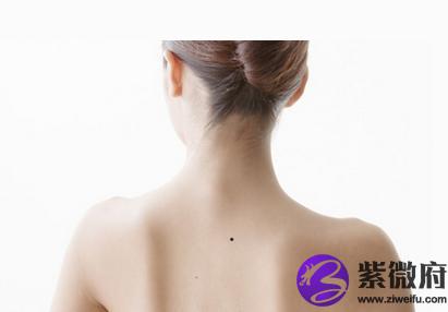 这几处长痣的人此生非富即贵