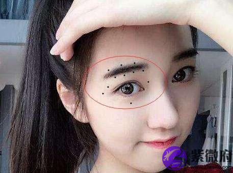 黑色发亮发紫闪亮晶莹者为吉利,又称为"美人痣"