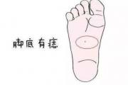 脚下有痣有什么意义 脚下有痣好不好