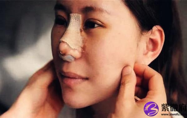 从生辰看你可以整容吗