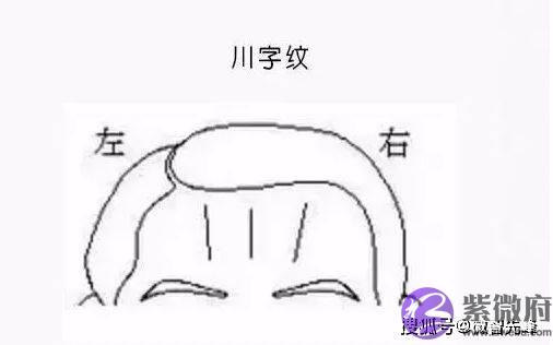 额头有天柱纹的人，通常可成就一番事业