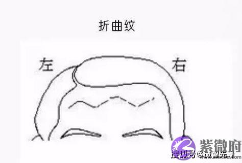 额头有天柱纹的人，通常可成就一番事业