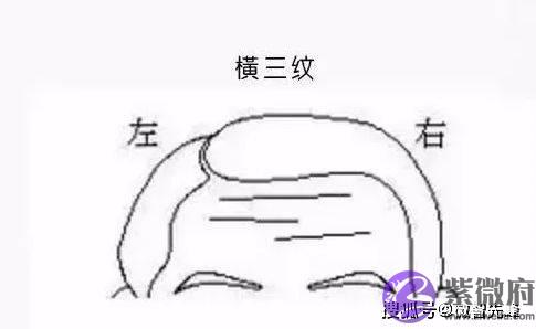 额头有天柱纹的人，通常可成就一番事业