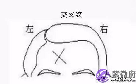 额头有天柱纹的人，通常可成就一番事业