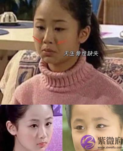 杨紫的法令纹，到底怎麽消失的！