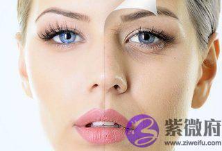 “法令纹”女性的天敌