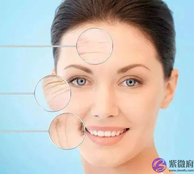 女人长法令纹显老! 教你正确淡化法令纹, 肌肤紧致细腻