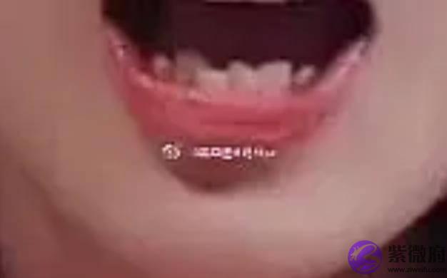 杨超越牙齿上排很整齐，下排牙齿像乱长的野草，参差不齐