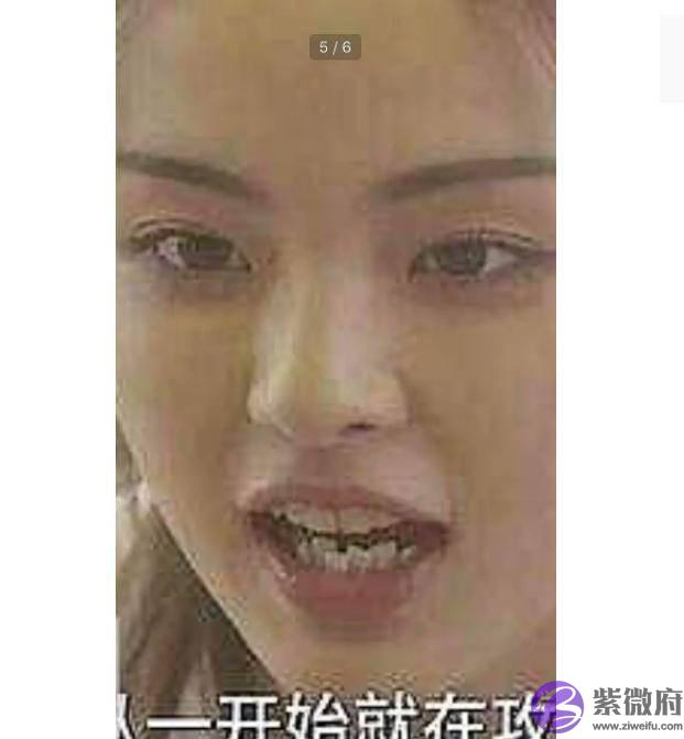 杨超越牙齿上排很整齐，下排牙齿像乱长的野草，参差不齐
