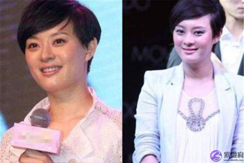 同样28岁生孩子，选择剖腹产的杨幂，和顺产的孙俪，如今差距明显