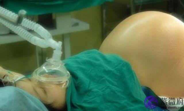 女人选择剖腹产的4个原因，老公快来看看，最后一个和你有关！