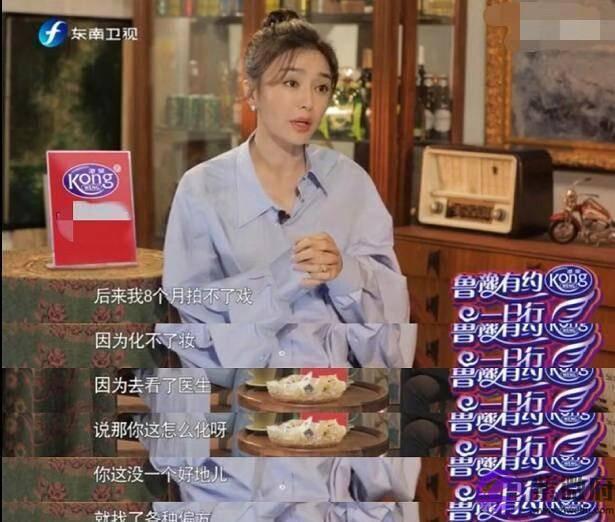 秦岚自曝差点毁容的心酸经历，曾八个月没有拍戏！