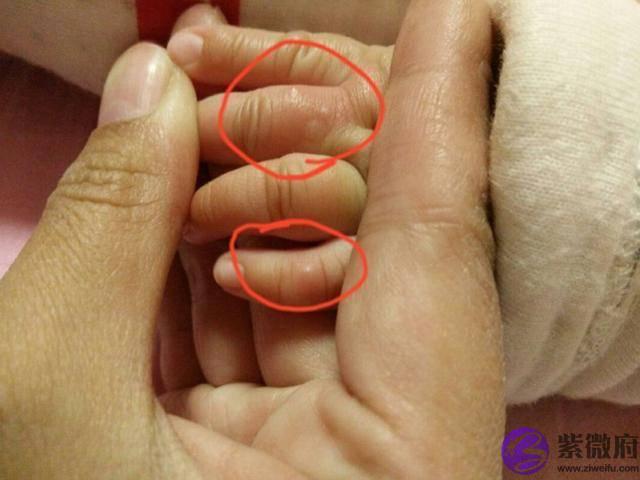 孩子聪明不聪明，看看小手就知道，智商的高低在手上就有信号