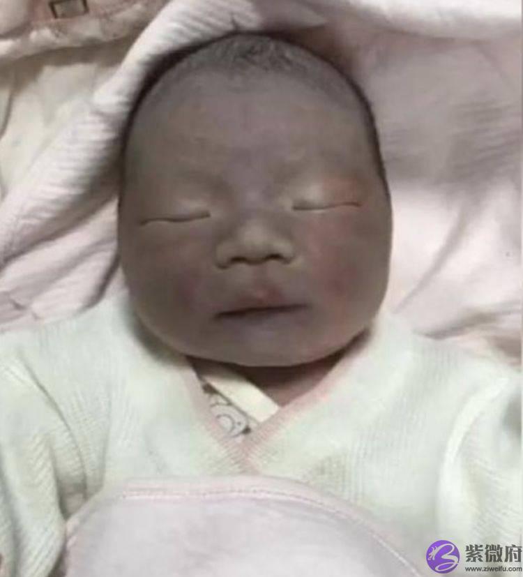 “黑脸宝宝”火了，出生时被全网嘲笑，模样长开后人见人夸