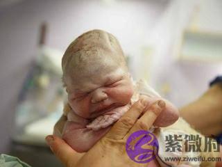 准妈妈做四维彩超，竟被宝宝丑哭，网友爆笑：还没出生就被嫌弃了